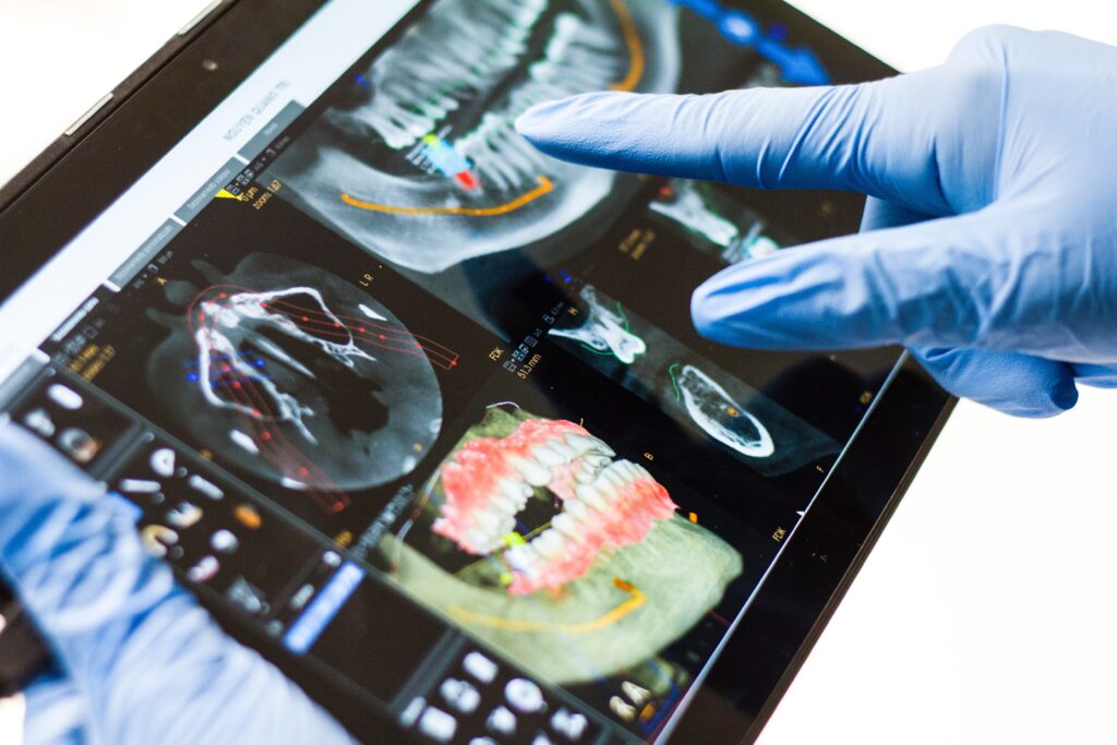 X Ray from different angles Dental Hygienist Wallingford